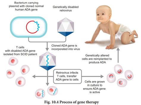 Gene Therapy - Applications of biotechnology