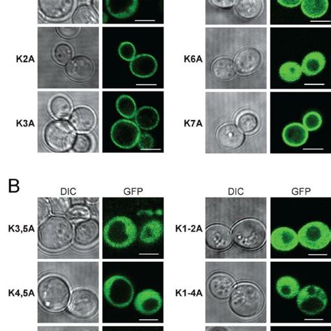 Localization Of Gfp Tagged Wt And The Indicated Single A And Multiple