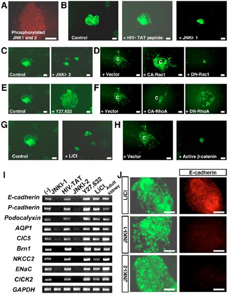 PCP Pathways Regulate Colony Size And The Differentiation Of