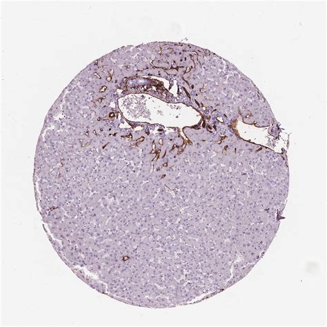 Tissue Expression Of CD34 Staining In Liver The Human Protein Atlas