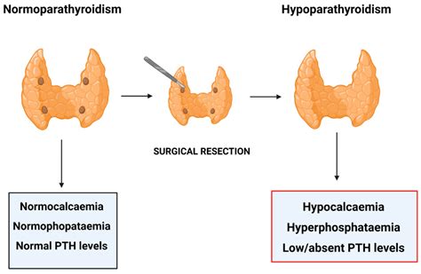 Ijms Free Full Text Hypoparathyroidism State Of The Art On Cell