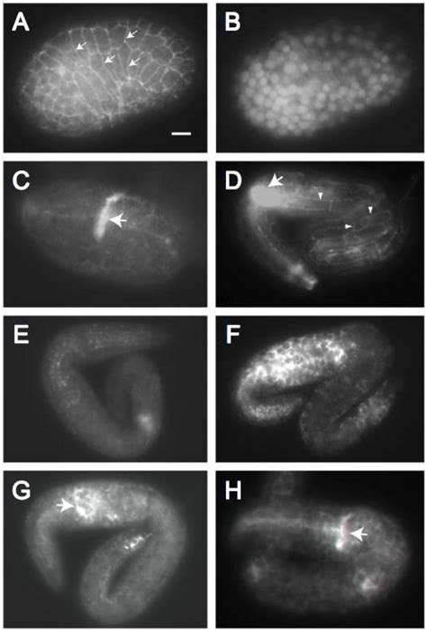 UNC 34 Localizes To Apical Junctions And Neuronal Processes We Stained