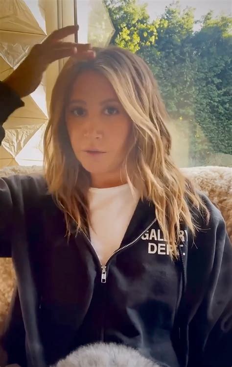 Ashley Tisdale Reveals Alopecia Struggles