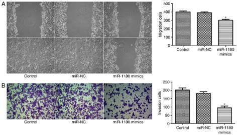 MiR 1180 Inhibits The Migration And Invasion Of DU145 Cells A Wound