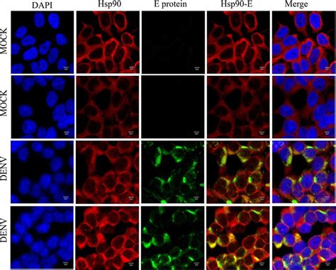 Colocalization Of Hsp90 And DENV Envelope E Protein HEK293T 17 Cells