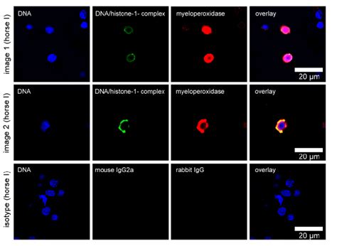 Ex Vivo Neutrophil Extracellular Trap NET Detection In Vitreous Body