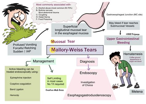 Boerhaave Syndrome Vs Mallory Weiss Tear Ouch 🤮 #health