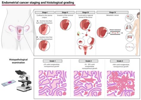 Cancers Free Full Text The Role Of Mirnas In The Regulation Of