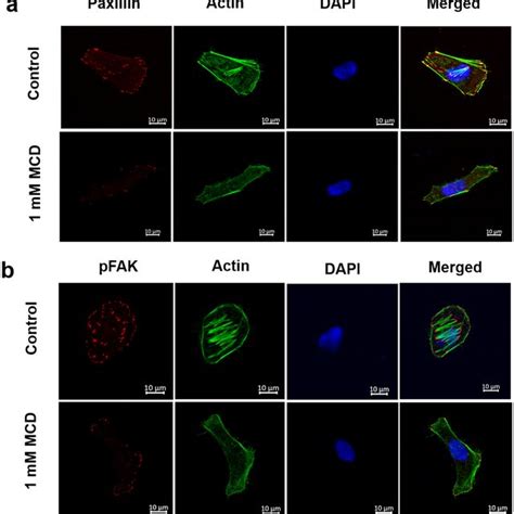 MCD Treatment Reduced The Expression Of Initial And Mature Focal