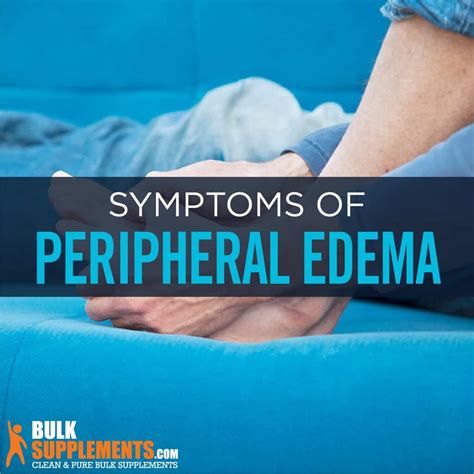 Peripheral Edema: Symptoms, Causes & Treatment