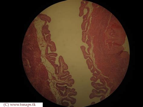 Histology Slides Database: Fallopian Tube histology Slides