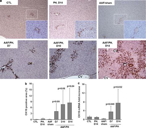 Liver Progenitor Cells Lpc Expansion A Representative Pictures Of Download Scientific