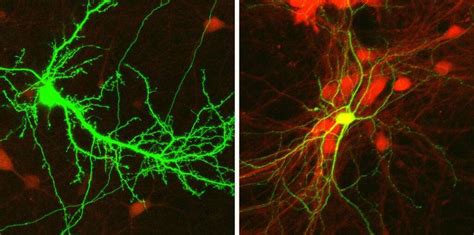 Excitation Inhibition Robustness In Neuronal Networks Elisha Moses Lab