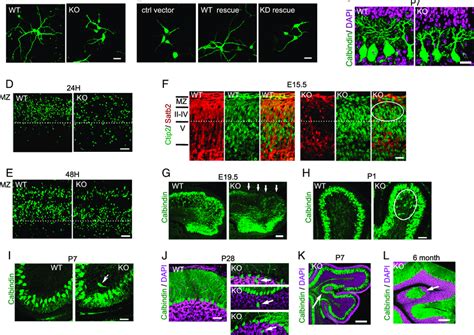 Ip K Deletion Causes Neuronal Cell Migration Defects And Brain