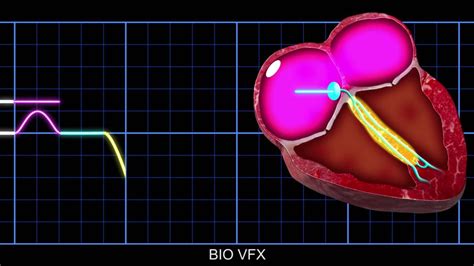 Video: Animation: Conduction of electrical impulses through the heart