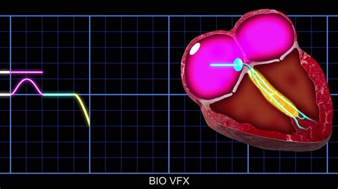 Video: Animation: Conduction of electrical impulses through the heart