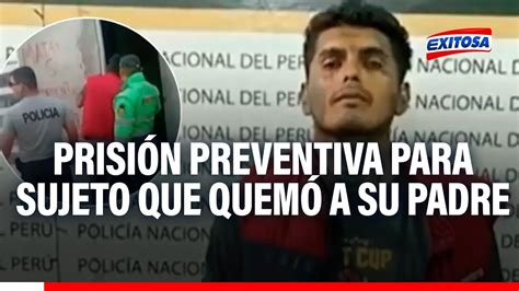 Nuevo Chimbote Dictan prisión preventiva a sujeto que quemó a su