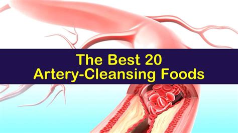 The Best 20 Artery Cleansing Foods