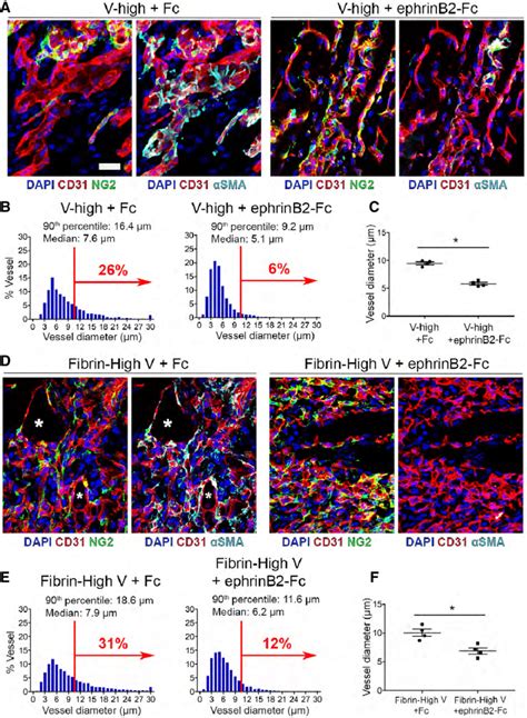 Activation Of Ephb4 By Ephrinb2 Fc Prevents Aberrant Angiogenesis A F Download Scientific