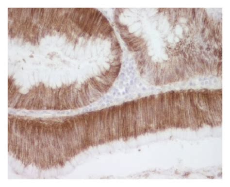 Immunostaining Of Colon Adenoma A Normal Colon B Normal Kidney