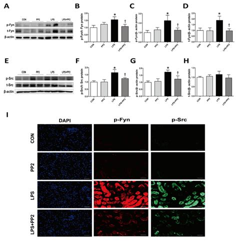 PP2 Inhibits Src And Fyn Kinase Expression In LPS Induced AKI Mice