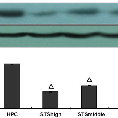 Expressions Of B Actin MGP BMP 2 And Cbfa 1 In STS Group 1 P