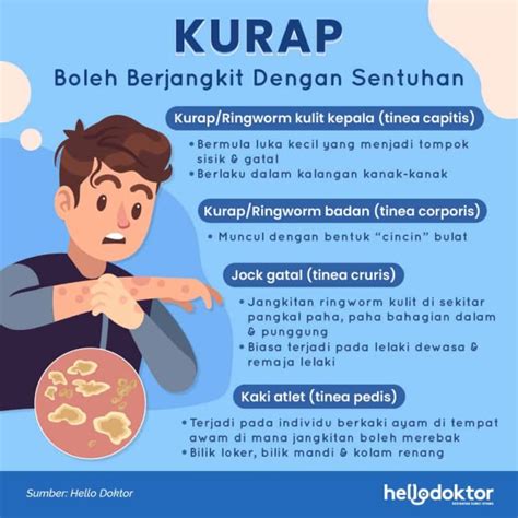 Ubat Kurap Celah Kangkang Ini Tip Pilih Rawatan Betul Atasi Kurap Paha