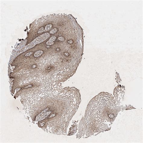 Tissue Expression Of Ier5 Staining In Vagina The Human Protein Atlas