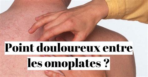 Comment Soulager Un Point Douloureux Entre Les Omoplates