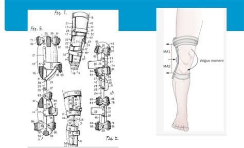 Development Embrace Yourself Leg Brace