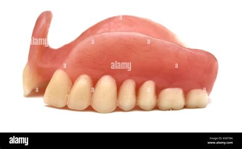 Dentadura parcial superior Imágenes recortadas de stock Alamy