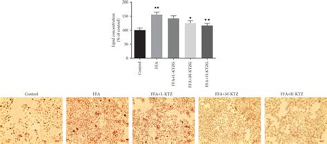 Effect Of Ktzg On Lipid Accumulation And Hepatic Steatosis In