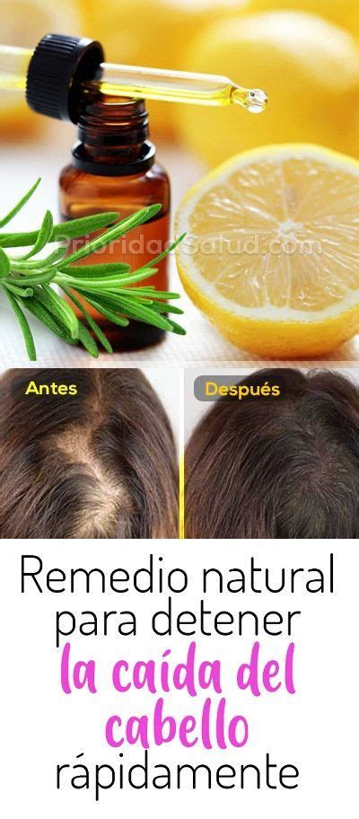 Remedio Natural Para Detener La Caida De Pelo Alopecia Calvicie