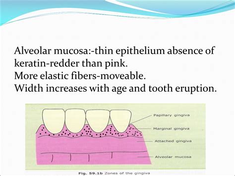 Ppt Gingival And Periodontal Diseases In Children Powerpoint