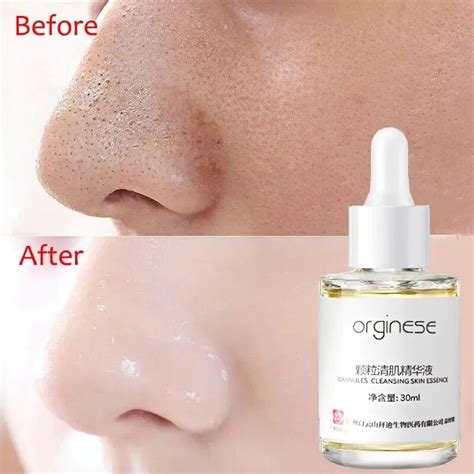 Lactobionic Acid Pore Shrink Face Serum Hyaluronic Acid Moisturizing