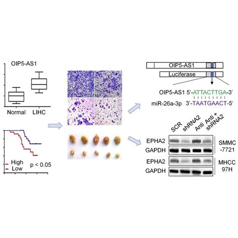 Long Noncoding RNA OIP5 AS1 Promotes The Progression Of Liver