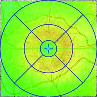 Etdrs Grid Etdrs Grid Fovea In The Middle Of The Circle With A