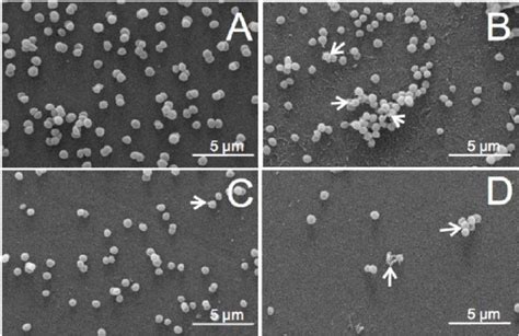 Scanning Electron Microscopy With Staphylococcus Aureus Cells A