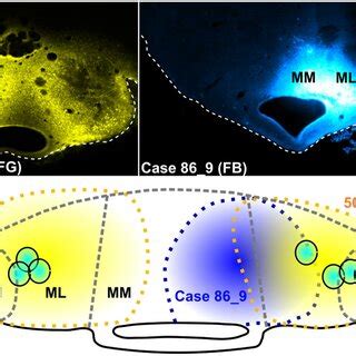 Mammillary Body Injection Sites Photomicrographs Of Two Representative