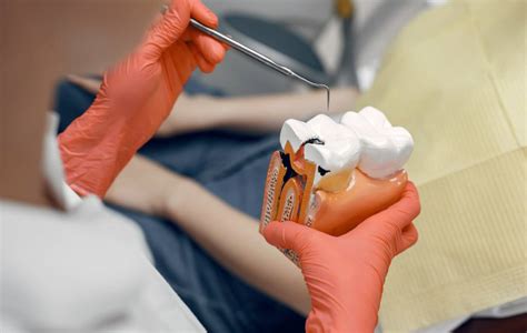 Necrosis pulpar Todo lo que debes saber Nart Clínica Dental