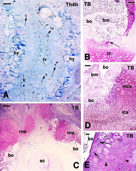 Autoradiography Of Inter Vertebral Cartilage A A Carolinensis And