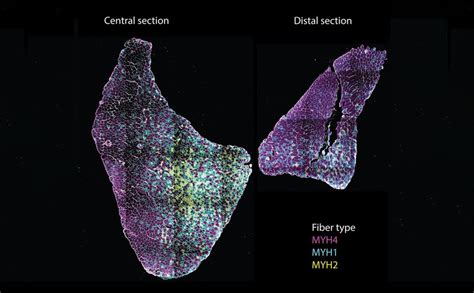 Mapping muscle architecture - reNEW