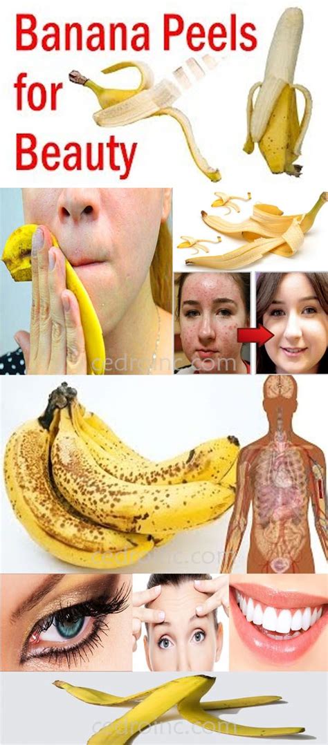 10 Amazing Benefits And Uses Of Banana Peels Hautpflege Haut Beauty