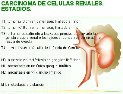 C Ncer Renal