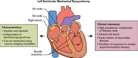 Neurometabolism And Ventricular Dyssynchrony In Patients 47 Off