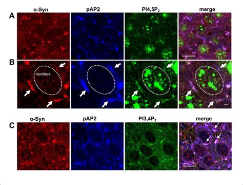 Syn And Pip At Ccp In Mouse Brains A Paraffin Embedded Section