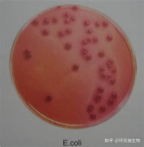 【速看】常见微生物在常见选择性培养基上的菌落特征 知乎