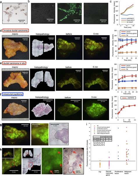 Immunohistochemical Staining Of Mcf 7 Cell Line For Ggt B Download Scientific Diagram