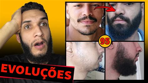 Evolu O Dos Inscritos Minoxidil Youtube