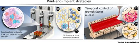 Printing New Bones From Print And Implant Devices To Bioprinted Bone